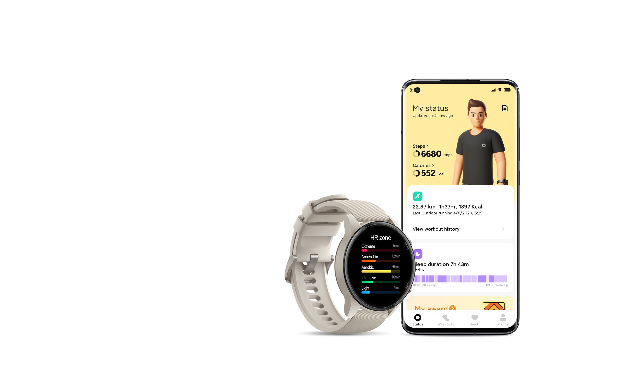 xiaomi x watch